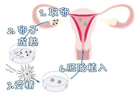素竹生殖医学中心